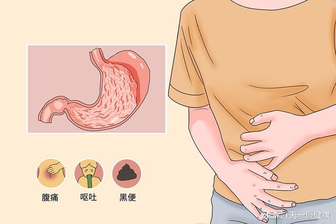 引发胃胀气的原因有些什么？J9九游会 九游会J9怎么预防和治疗？(图4)